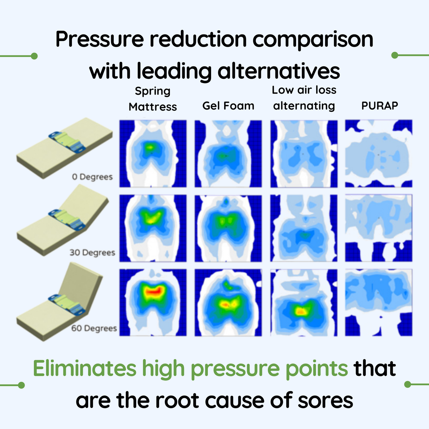 PURAP Pressure Relief Mattress System for Bedsore Prevention and Treatment